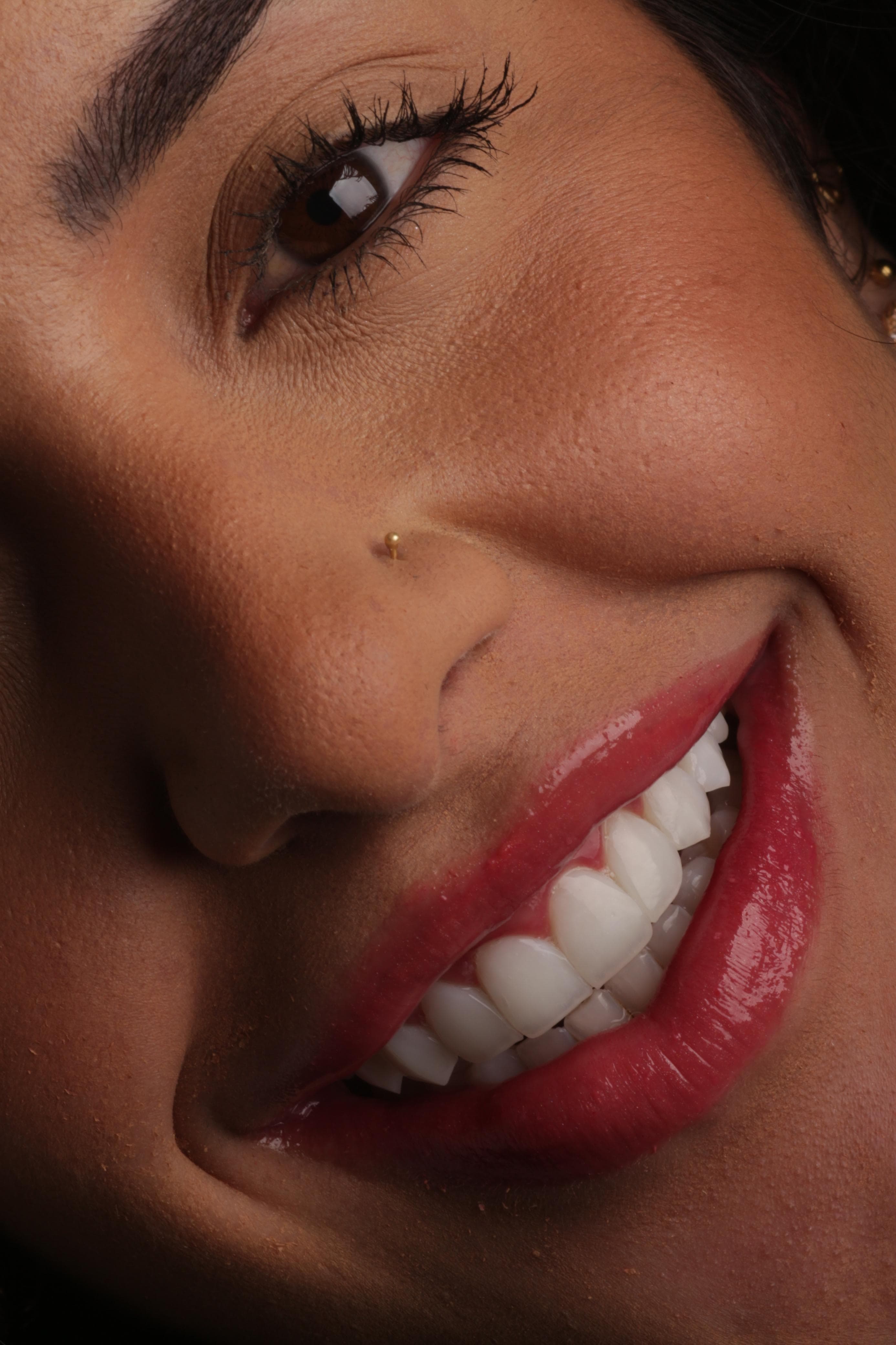 Lentes de Contato Dental em Porcelana