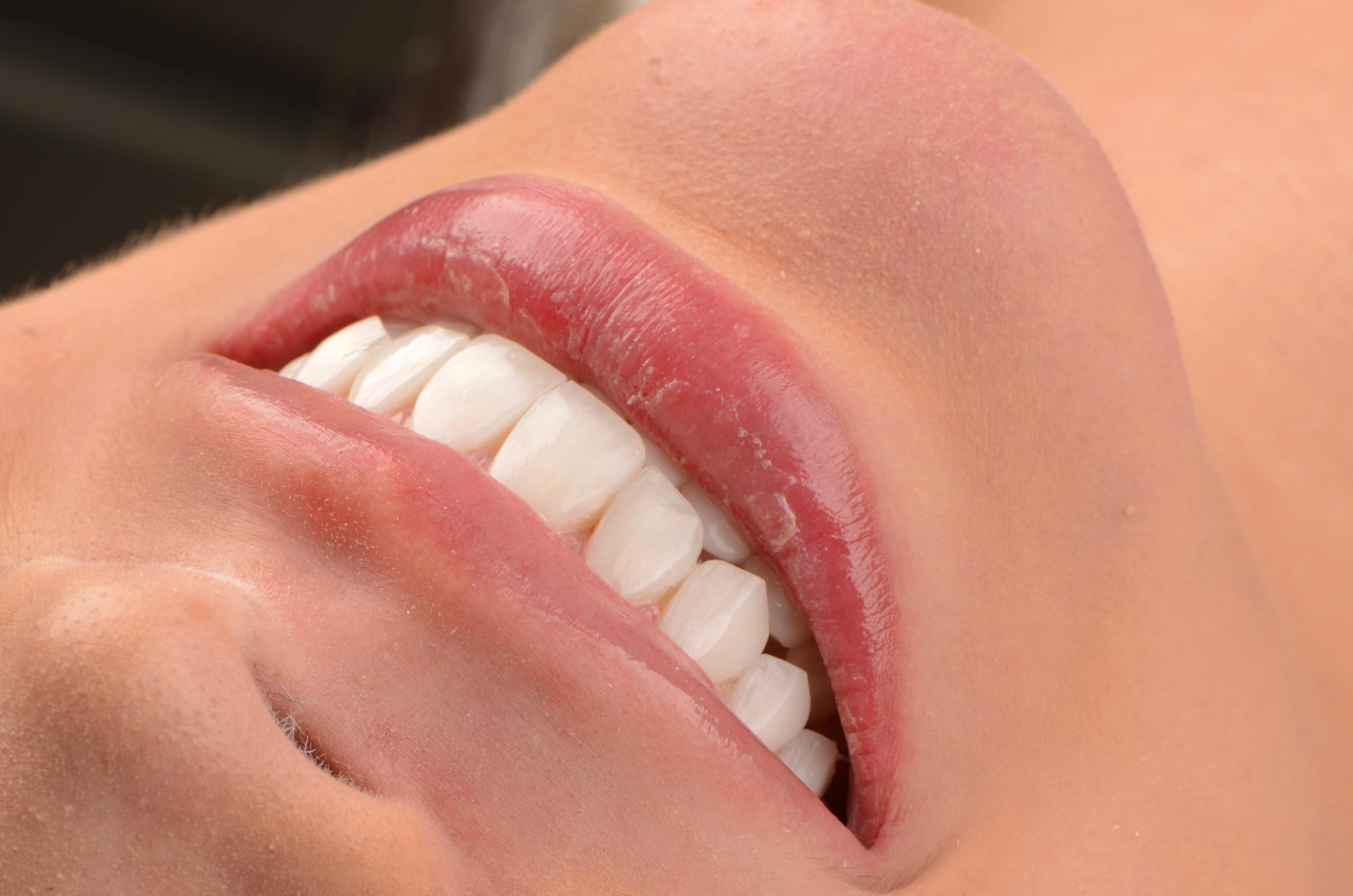 Estética Dental